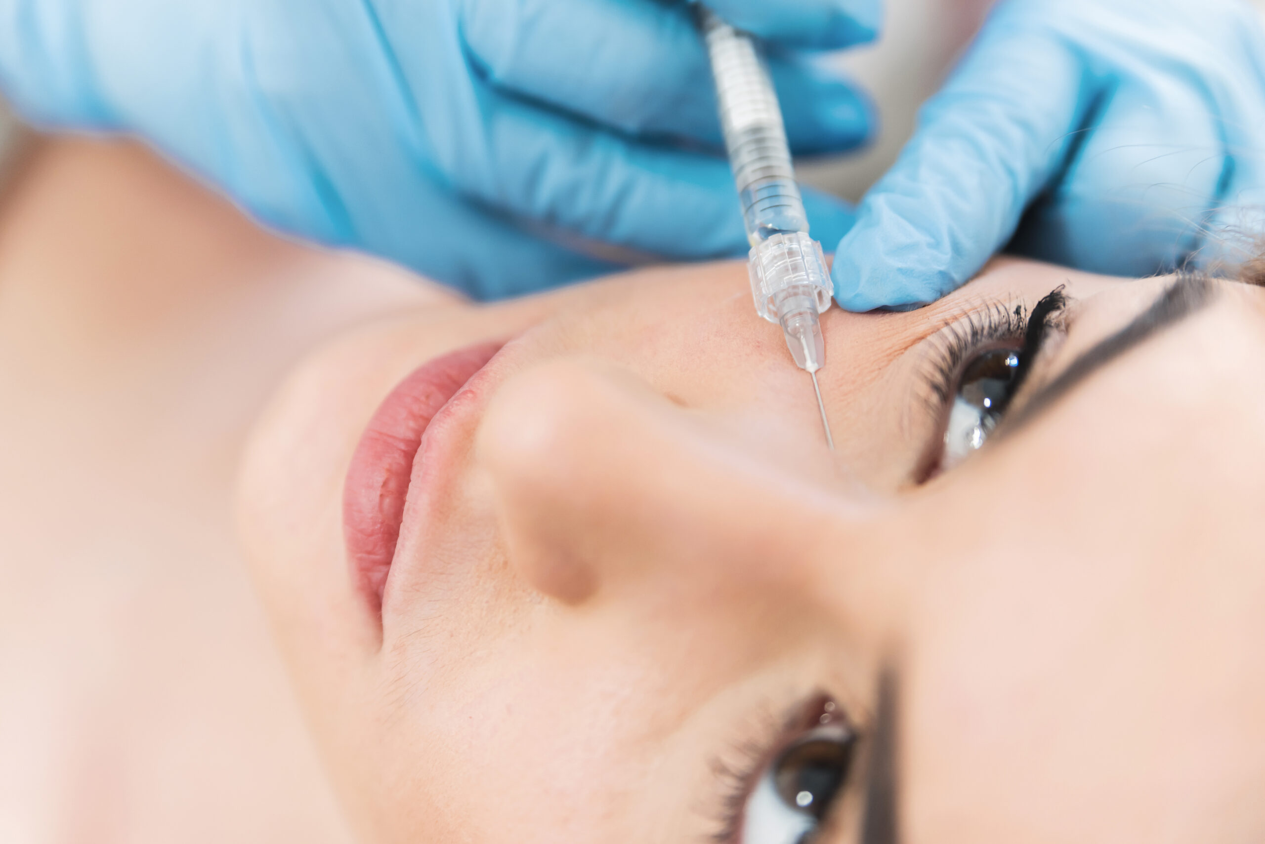 Dermal Fillers Nasal Folds: Treatment Guide for Clarksville, TN Patients img